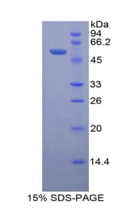 Mouse PRL / Prolactin Protein (Recombinant His-GST)