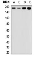 ERBB3 / HER3 Antibody (N-Terminus)