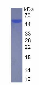 Human CTSD / Cathepsin D Protein (Recombinant His, N-Terminal)