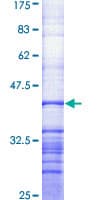Human ABCA1 Protein (Recombinant GST, N-terminus)