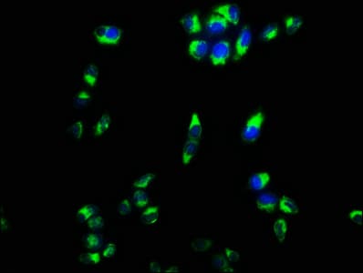 Polyclonal Rabbit anti-Human CPEB4 Antibody (WB)