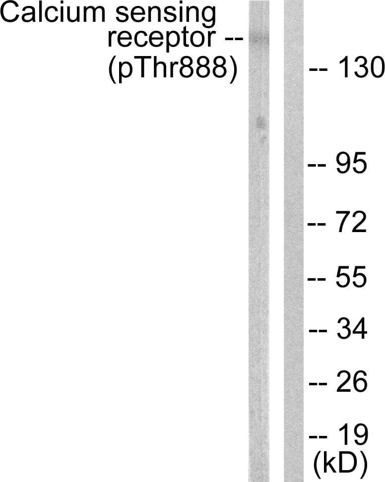 CASR/Calcium Sensing Receptor Antibody (phospho-Thr888)