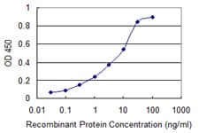 SRD5A2 Antibody (clone 1F4)