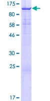 Human KDM3B / JMJD1B Protein (Recombinant GST)