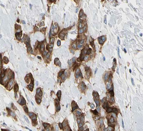 KRT7 / CK7 / Cytokeratin 7 Antibody