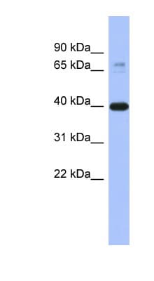 Polyclonal Rabbit anti-Human MAPK3 / ERK1 Antibody (C-Terminus, WB)