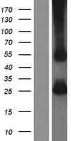 Human TAPBP / Tapasin Protein (Over-Expression Lysate Myc-DDK (Flag))