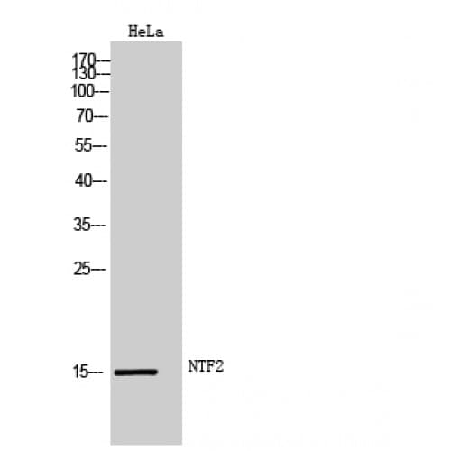 Polyclonal Rabbit anti-Human NUTF2 / PP15 Antibody (40-120 aa, Internal, IHC, WB)