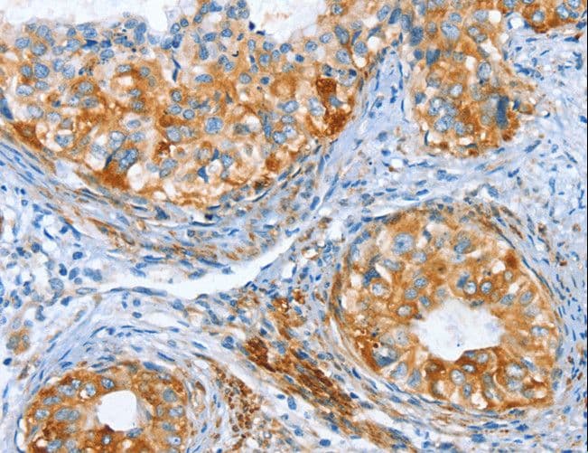 Polyclonal Rabbit anti-Human ARA9 / AIP Antibody (IHC)