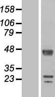 DPCD Protein (Over-Expression Lysate Myc-DDK (Flag))