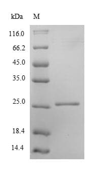 Human PRDX2 / Peroxiredoxin 2 Protein (Recombinant 6His, N-terminus)