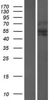 Human AIRE Protein (Over-Expression Lysate Myc-DDK (Flag))
