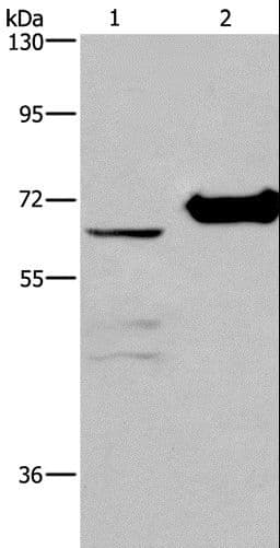 CHDH / CHD Antibody