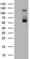 FGFR3 Antibody (aa23-375, clone OTI1B10)