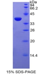 Human FBLN4 / EFEMP2 Protein (Recombinant His-GST)