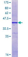 Human CASR/Calcium Sensing Receptor Protein (Recombinant GST, N-terminus)