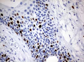 MKI67 / Ki67 Antibody (aa1160-1493, clone OTI9D4)