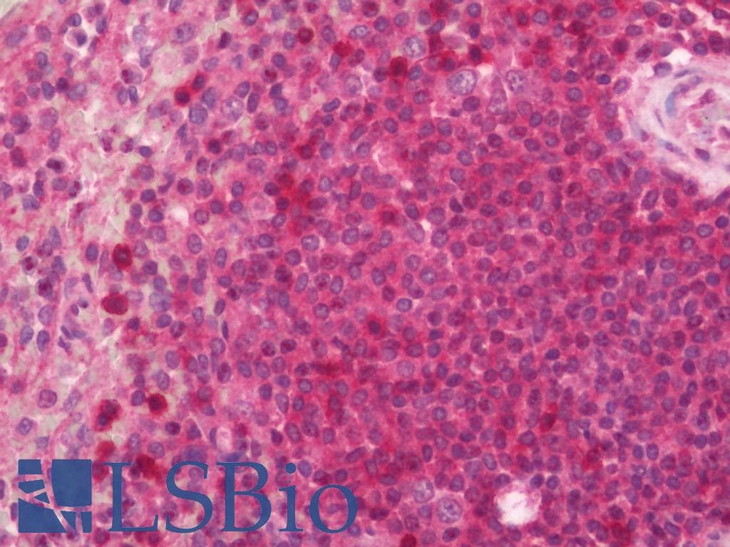 IHC-plus™ CD6 Antibody (clone UMCD6/3F7B5)