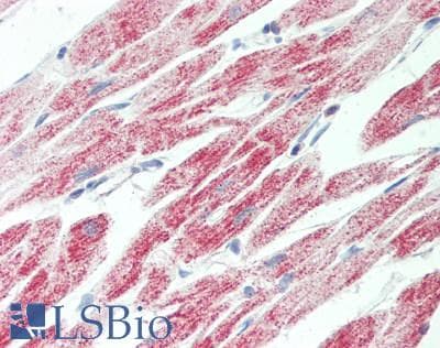 IHC-plus™ ATP5C1 Antibody (aa272-286)