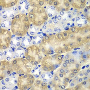 Polyclonal Rabbit anti-Human AMY1A / Salivary Amylase Antibody (IHC, WB)