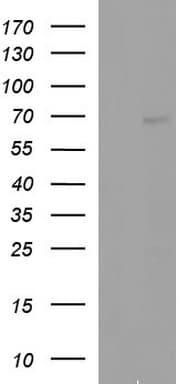 ALB / Serum Albumin Antibody (aa19-609, clone OTI5H2)