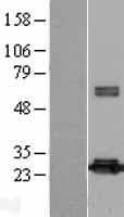 Human PRDX4 / Peroxiredoxin 4 Protein (Over-Expression Lysate Myc-DDK (Flag))