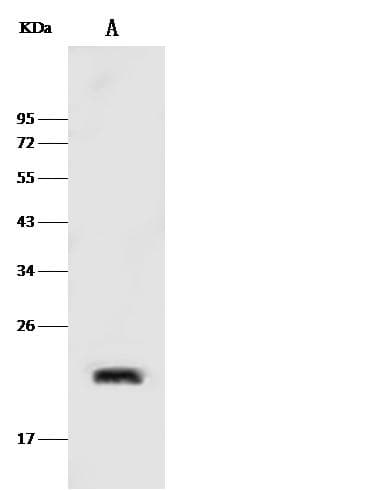 Polyclonal Rabbit anti-Human CAV2 / Caveolin 2 Antibody (Preservative Free, WB)