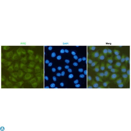 FAK / Focal Adhesion Kinase Antibody