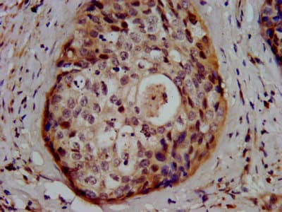 Polyclonal Rabbit anti-Human GSS / Glutathione Synthetase Antibody (IHC, WB)