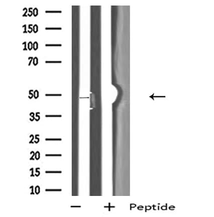 OPRK1 / Kappa Opioid Receptor Antibody
