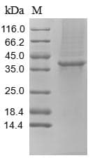 Rabbit TFPI / LACI Protein (Recombinant 10His, N-terminus)