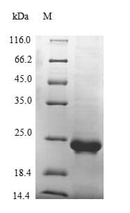 Mouse VWF / Von Willebrand Factor Protein (Recombinant 10His, N-terminus + Myc, C-terminus)