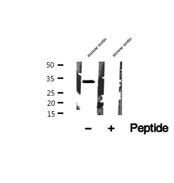 STX17 / Syntaxin 17 Antibody