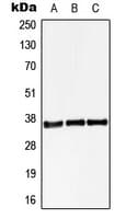 STARD10 Antibody (Internal)