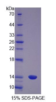 Pig S100A8 / MRP8 Protein (Recombinant His-S)