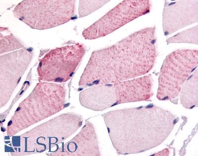 PathPlus™ WNK1 Antibody (C-Terminus)