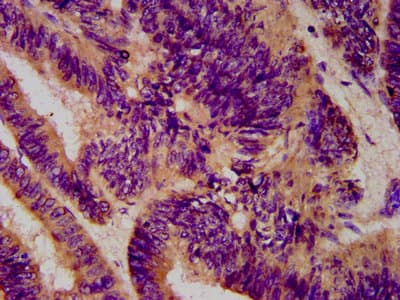CTAGE5 Antibody