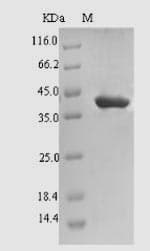 Ipomoea batatas Sporamin A Protein (Recombinant 6His-SUMO, N-terminus)