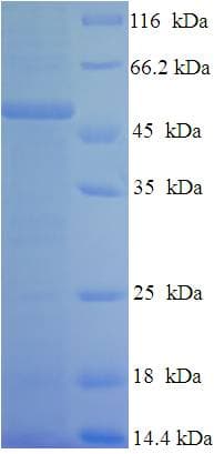 Human CSF2RA / CD116 Protein (Recombinant His-SUMO)