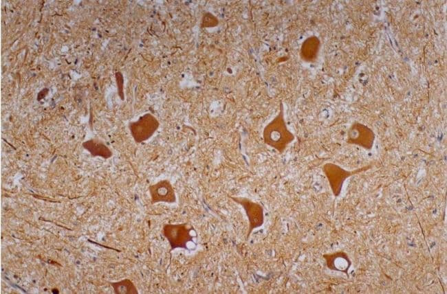 Monoclonal Mouse anti-Mammal NEFH / NF-H Antibody (clone NF-01, IHC, WB)