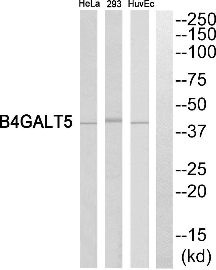 B4GALT5 Antibody