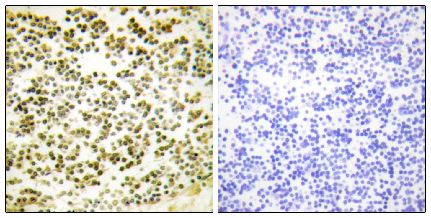 RBL1 / p107 Antibody (phospho-Thr369)