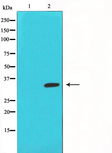 E2F5 Antibody