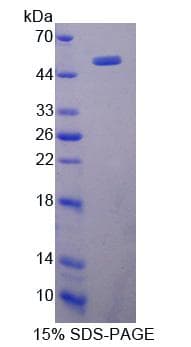 Rat CD74 / CLIP Protein (Recombinant His-GST)