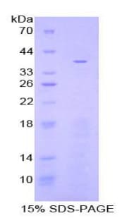 Rat Apolipoprotein C-I (Recombinant His-GST)