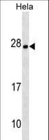 ZMAT4 Antibody (aa11-38)