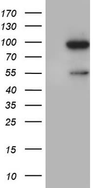 VWF / Von Willebrand Factor Antibody (aa764-1263, clone OTI8A6)