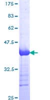 Human CD144 / CDH5 / VE Cadherin Protein (Recombinant GST, N-terminus)