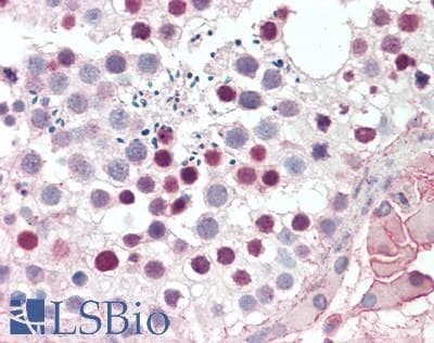 IHC-plus™ Polyclonal Rabbit anti-Human SIVA1 / SIVA Antibody (IHC, WB)
