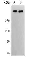 Polyclonal Rabbit anti-Human EP400 / p400 Antibody (WB)